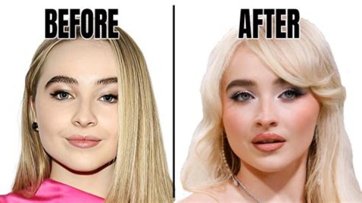 The Evolution Of Sabrina Carpenter's Lips: Before And After Lip Fillers
