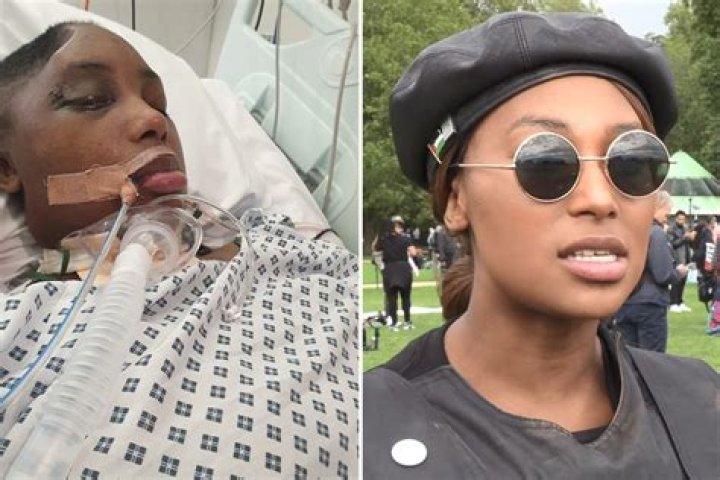 Activist Sasha Johnson lays bedridden one year after being shot in the head in harrowing pic shared by her family