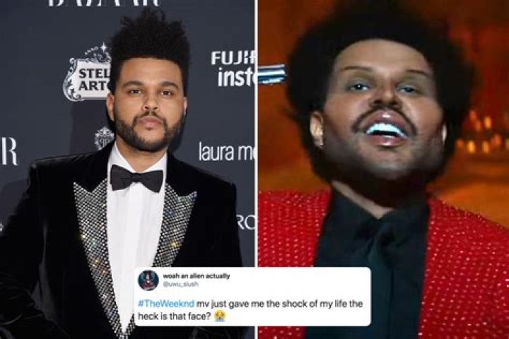 The Weeknd leaves fans 'scared' after debuting freaky face from ‘plastic surgery’ in new music video