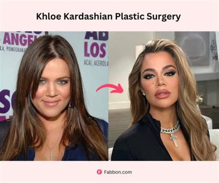 Tori Spelling is 'honored' fans think she looks like Khloe Kardashian after unveiling new face 'post-plastic surgery'