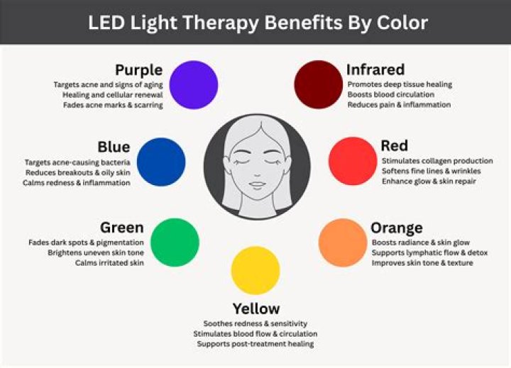 Quick Answer: What Color Of Led Lights Help With Headaches