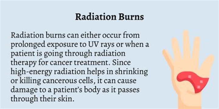 Quick Answer: What Does Electrical Burn Smell Like