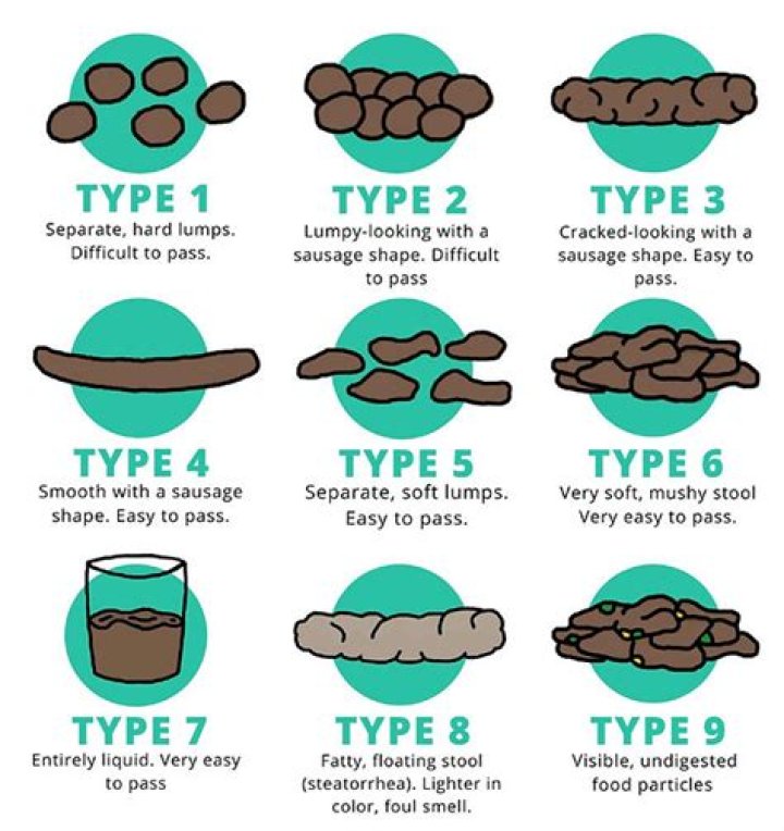 Question: What Does Fat In Stool Look Like