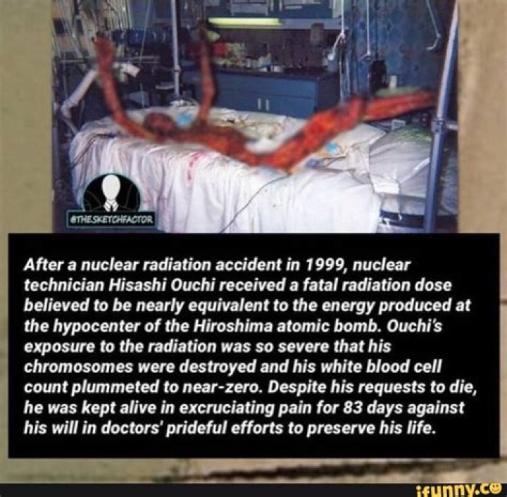 What Happened To Hisashi Ouchi: A Tragic Tale Of Nuclear Accident