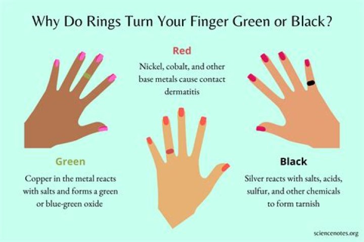 Question: What Metals Will Not Turn Your Finger Green