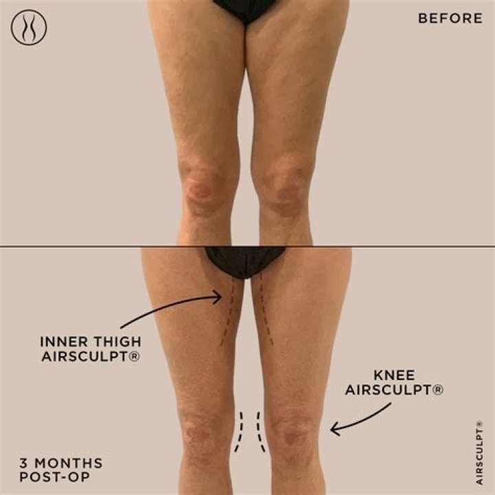 Question: When I Put My Car In Reverse It Jerks