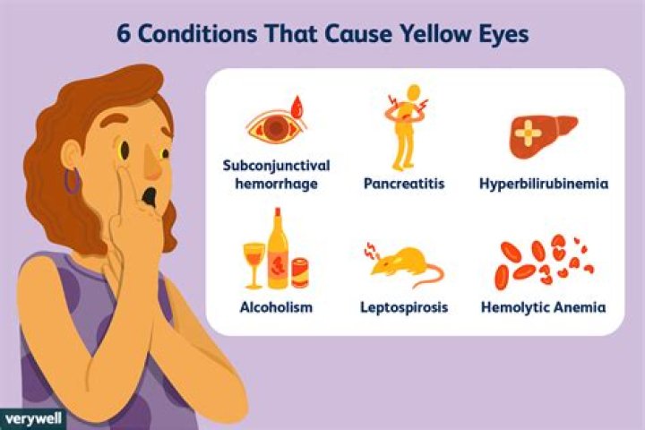 Question: Why Do I Keep Seeing Yellow Spots