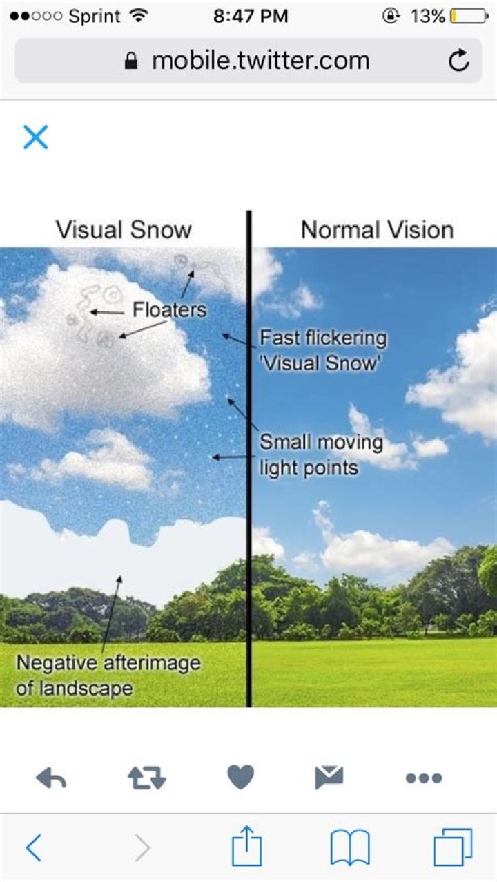 Question: Why Do I See Static