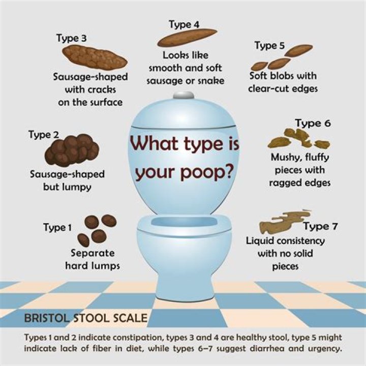 Why Is My Poop Messy When I Wipe