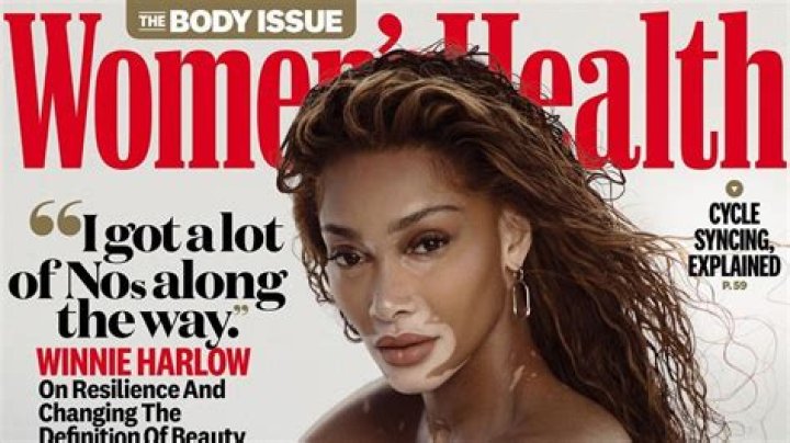 Winnie Harlow strips totally naked for very daring new photoshoot