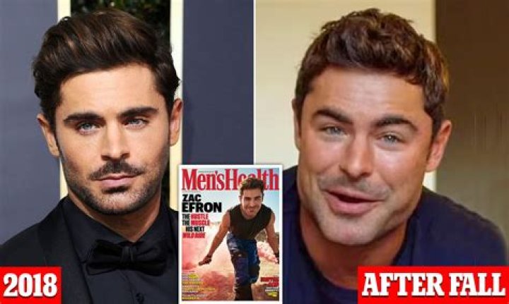 Zac Efron Reacts to Plastic Surgery Rumors After Viral Jaw Photo